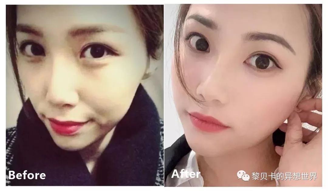 最短只要一年，这件事做对了堪比整容