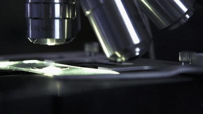 显微镜下的各种眼泪,显微镜下的眼泪原版