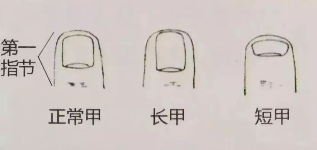 科普|指甲的状态反映了你身体的状况