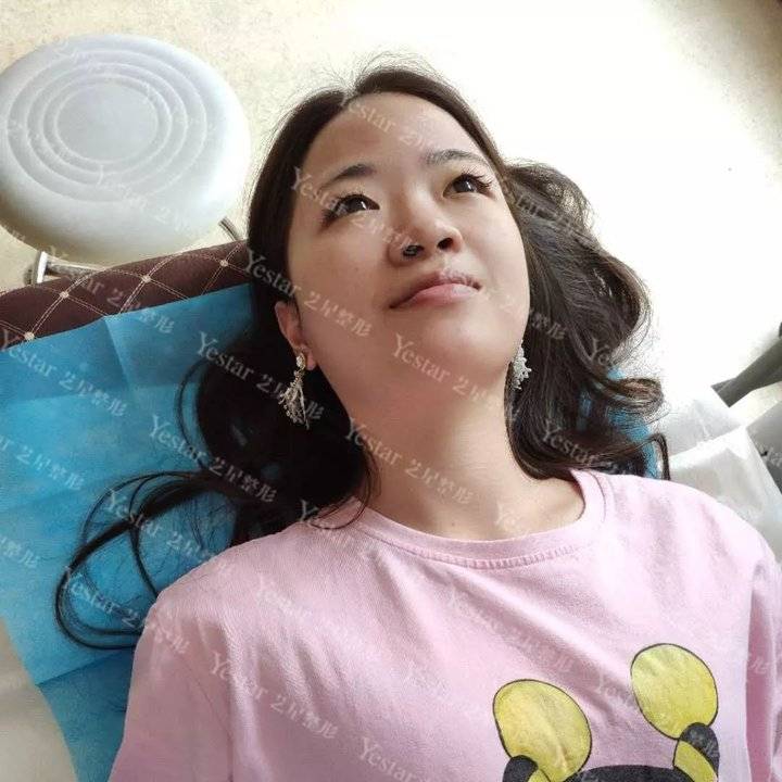 十大骗局肉毒素药,微整形注射假药案例