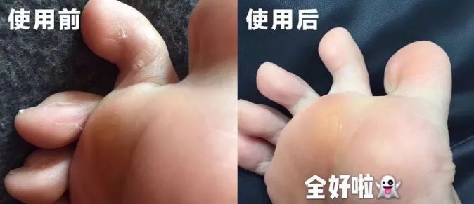 日本的脚到底臭不臭,为什么日本人的脚从来都不臭