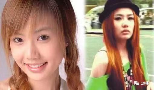 美丽女子整容失败,鼻整形失败多久可以修复