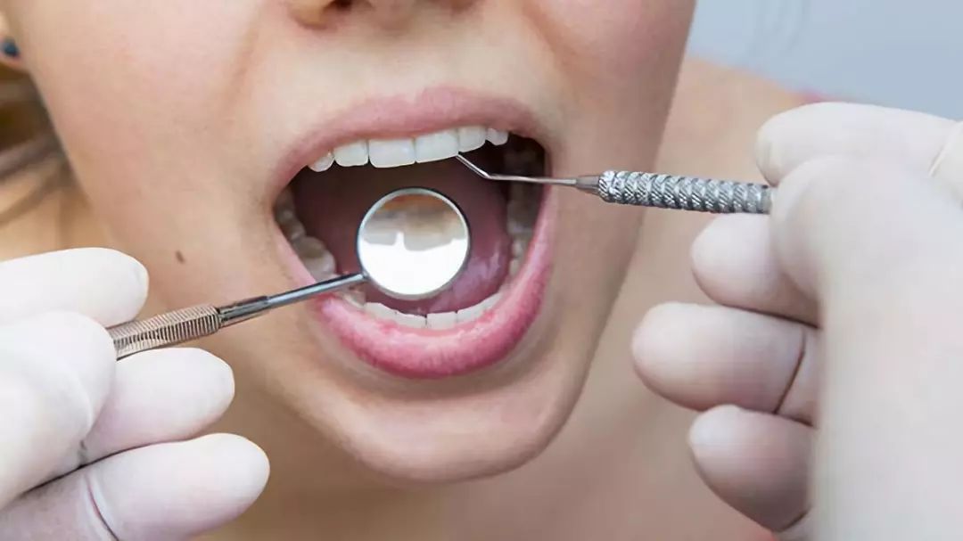 参半益生菌口腔含片,益生菌维生素e含片口腔护理