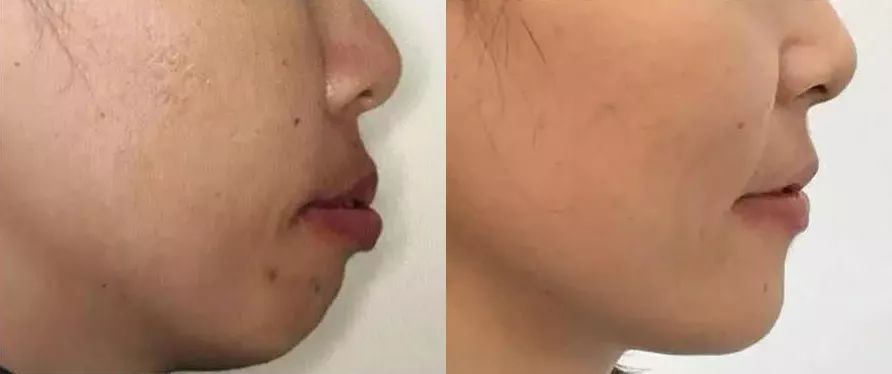 口腔疾病是最普遍的健康问题,牙齿疾病占口腔疾病的比例是多少