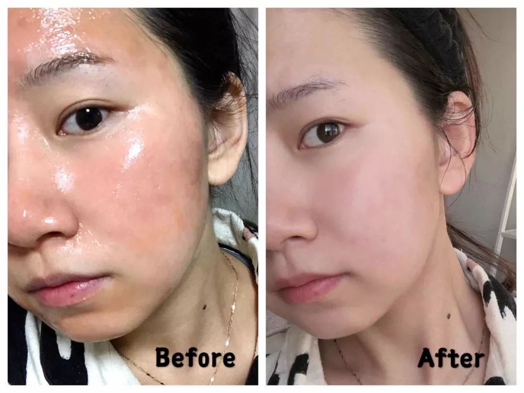 早晨起床对抗懒癌,懒癌晚期护肤的正确方法