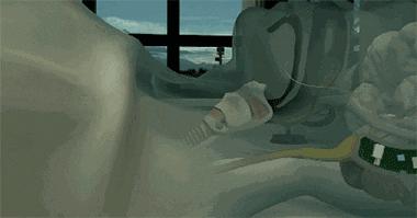 老公呼噜声让我彻夜难眠,老公呼噜声震天响