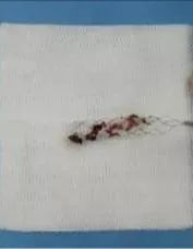 26岁小伙加班后头晕,28岁小伙熬夜加班49小时