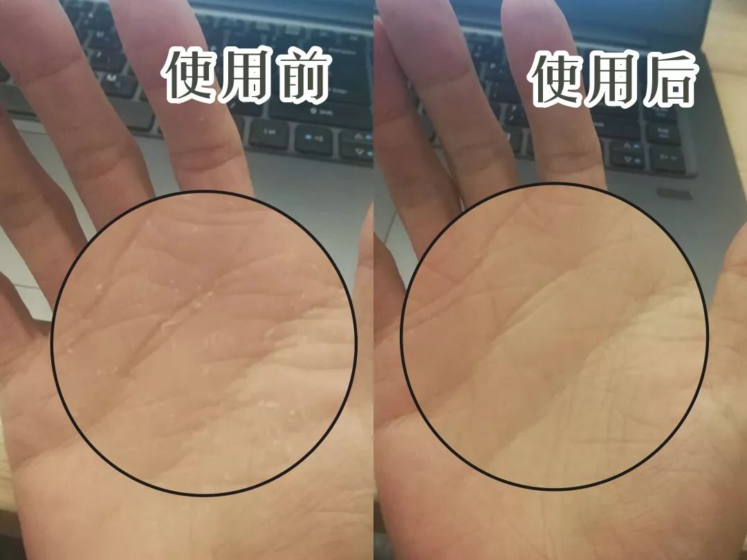 拯救手脚干裂,拯救起皮护肤品