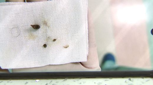 女孩肚子痛还流血,走路都不对劲了