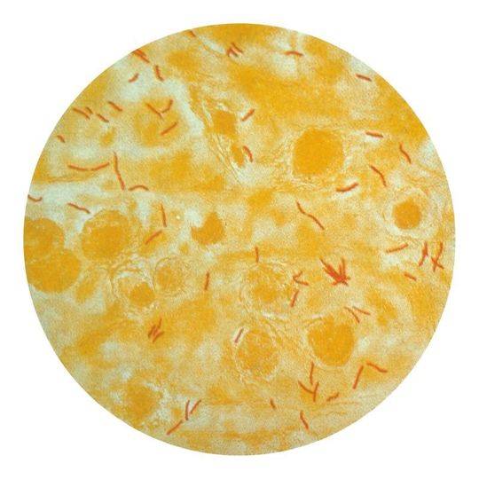 战疫纪实书籍,中国历史防疫斗争的启示