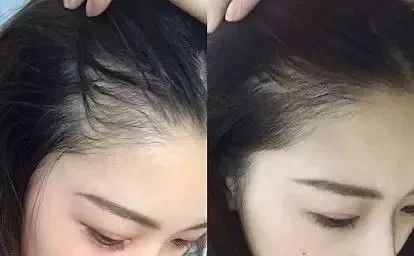 防脱发的生姜洗发水安利,官方推荐防脱洗发水