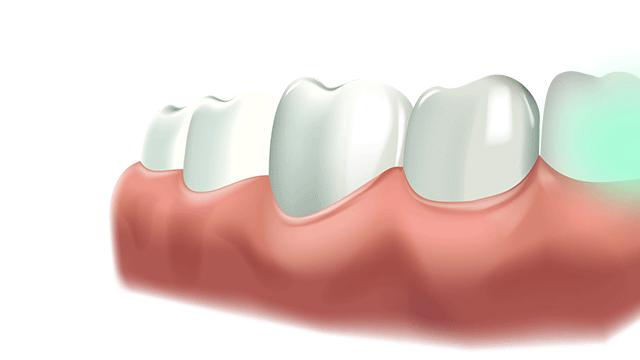 女明星祛口臭的偏方,明星用的口气清新剂