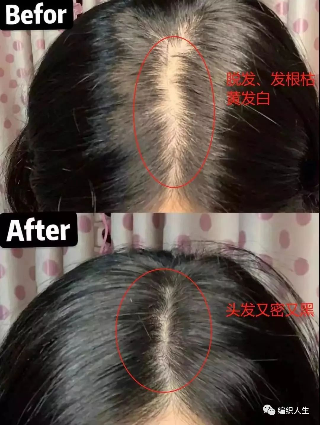 德国老太太用什么洗发水,93岁德国老太太