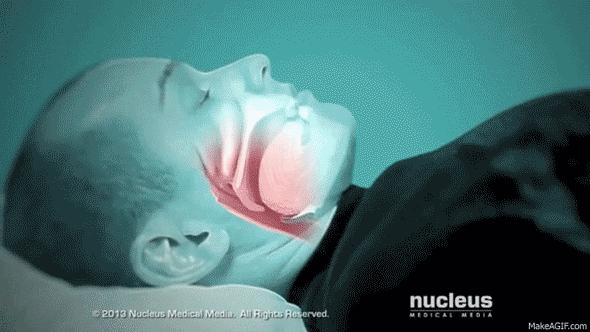 睡眠呼吸暂停是什么意思,呼吸睡眠暂停综合征英文