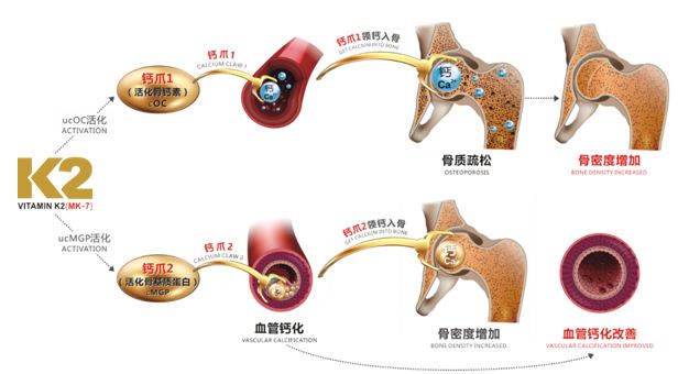 补钙是治疗骨质疏松的首选措施,补钙改善慢性疾病