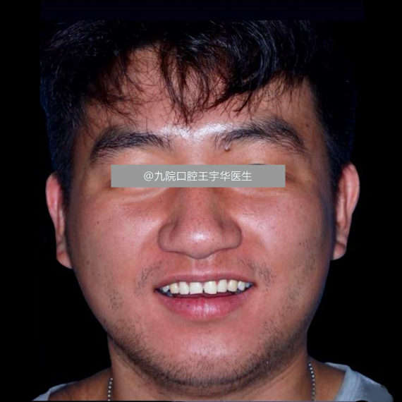 门牙中间有缝是否影响运势,门牙开缝是不是很丑