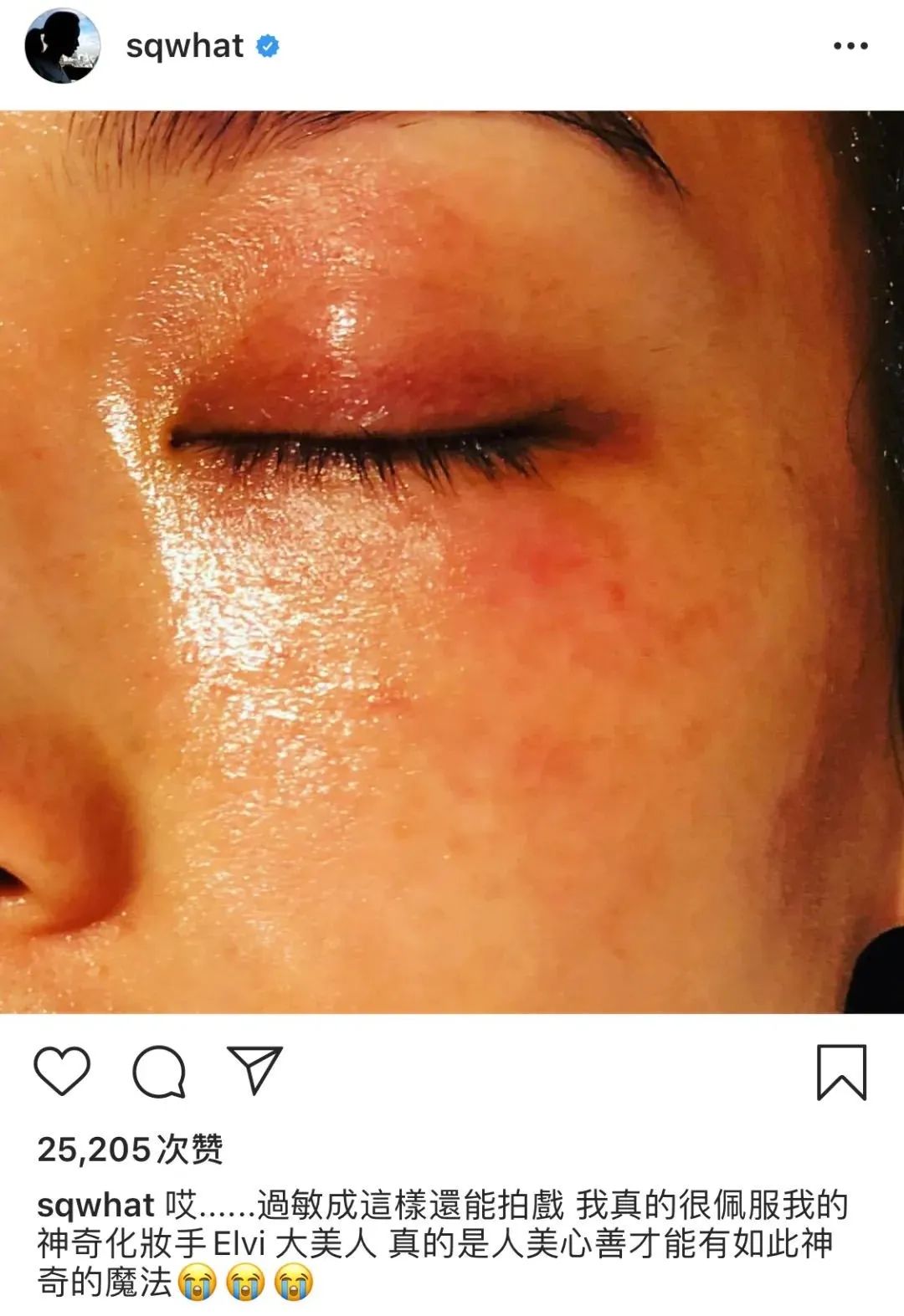 黑头痘印怎么去除,黑头痘印怎么消除学生党