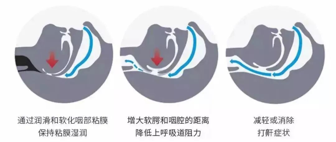 老公呼噜声让我彻夜难眠,老公呼噜声震天响