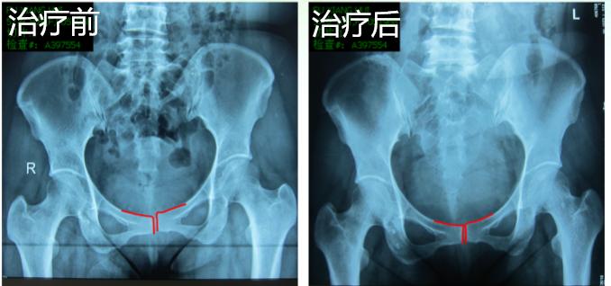 产后妈妈的守护神,保护好自己产后妈妈必看