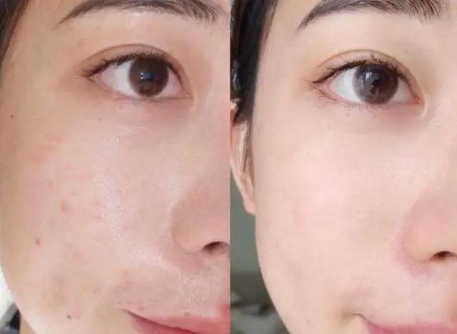 深扒明星美白抗衰秘籍!比防晒管用1000倍!4周逆袭成白皮,悄悄瘦掉8斤