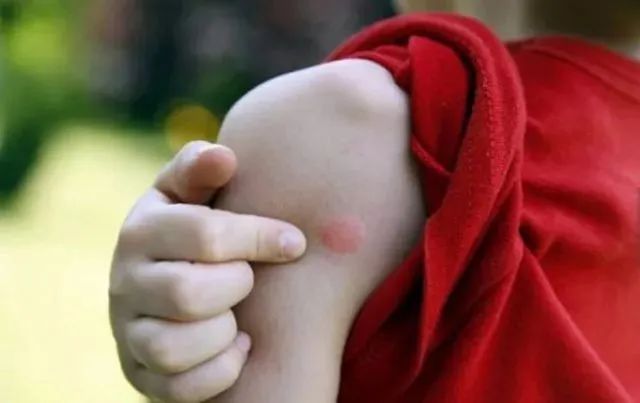 被疯抢的隐形蚊帐，随手一挂，蚊子全无