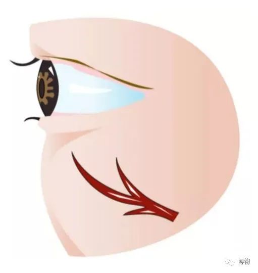 有黑眼圈适合什么颜色的卧蚕,黑眼圈适合什么颜色卧蚕