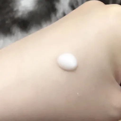 100个皮肤问题案例,世界上十大皮肤顽疾