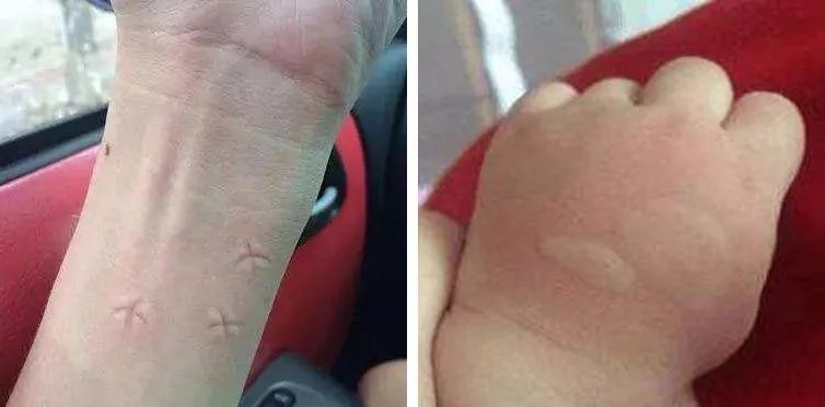 日本人驱蚊产品,日本人灭蚊