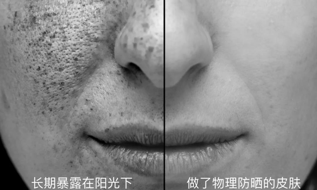 怎么正确涂防晒霜不会假白,涂了防晒霜被晒红