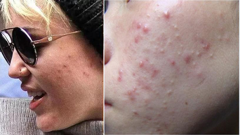 洗出脸上的脏东西解压,清除脸上斑块的产品