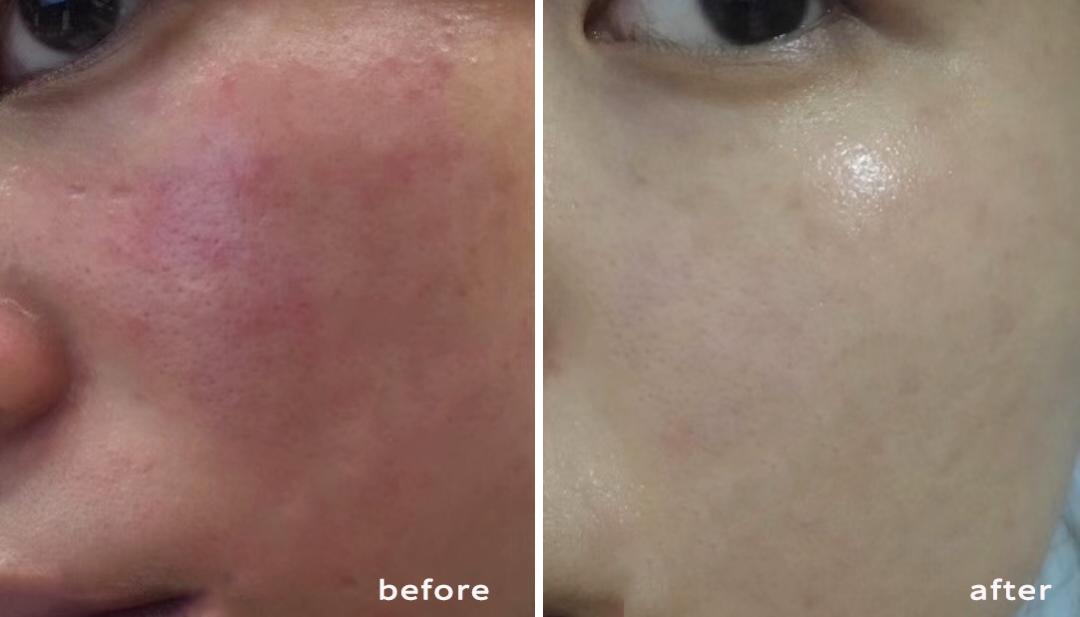 洗出脸上的脏东西解压,清除脸上斑块的产品