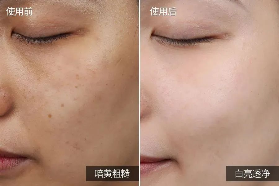 angelababy30岁素照,angelababy早期日本照