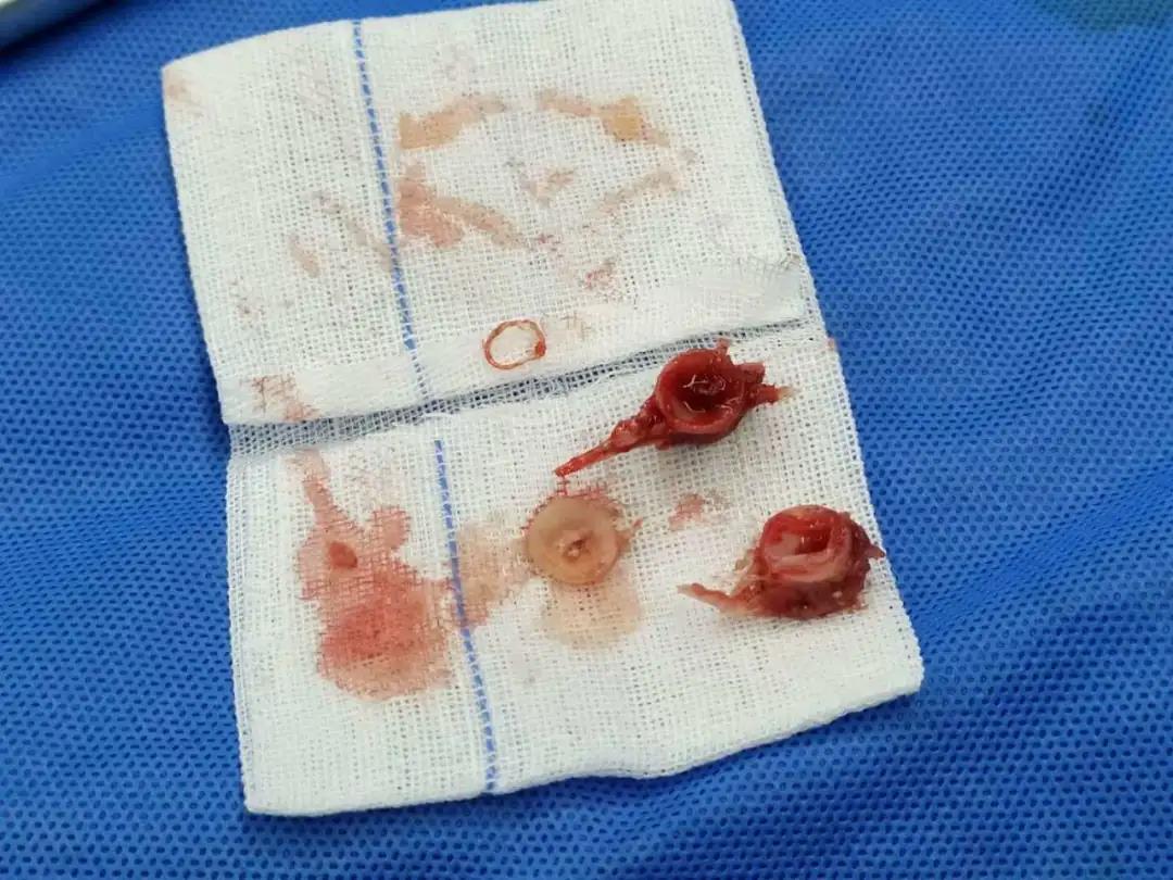 天呐,老人喝粥老是噎住