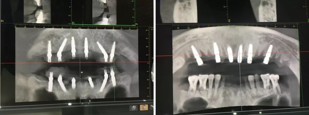 517吃货节来袭！缺它吃不快乐！千元补贴快领