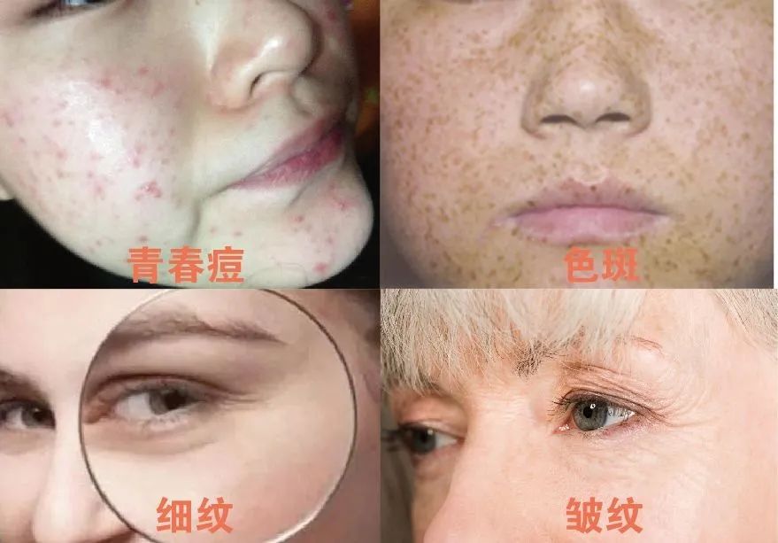 长期补充胶原蛋白的人怎么样了,长期喝胶原蛋白的人最后怎么样了