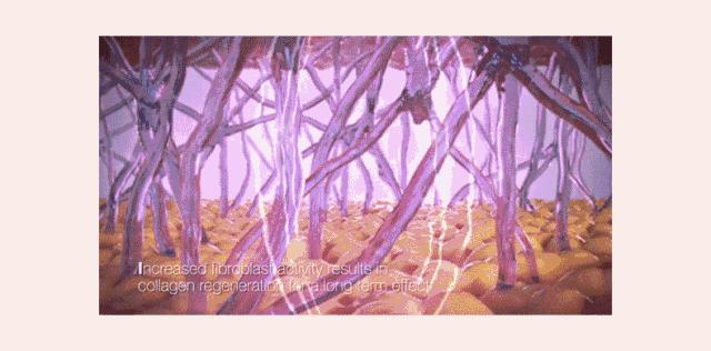 法令纹怎么办,脸上长皱纹怎么办