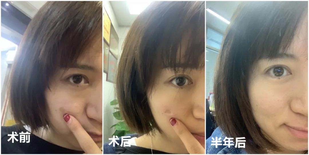 做完医美用可复美吗,你知道做完医美有多可怕