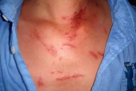 它来了，它来了，它跟着夏天飞来了！