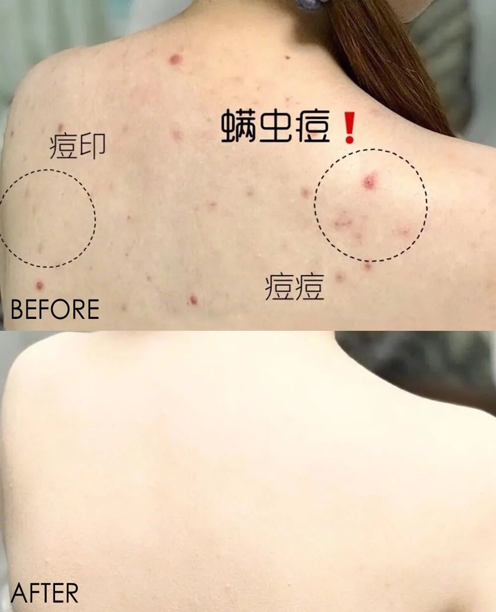 团|墙上插上它，24小时物理除螨，让千万螨虫集体自杀，比太阳暴晒强10000倍