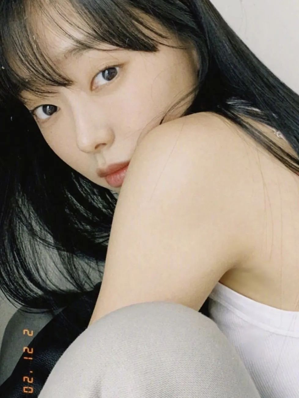 变双眼皮半个月后回到单眼皮,双眼皮怎么临时变成单眼皮