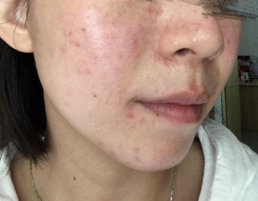 pony娴嬭瘯鐜涗附榛涗匠,pony鍖栧ザ娌瑰