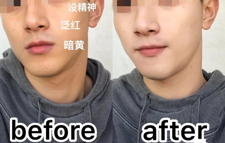 pony娴嬭瘯鐜涗附榛涗匠,pony鍖栧ザ娌瑰