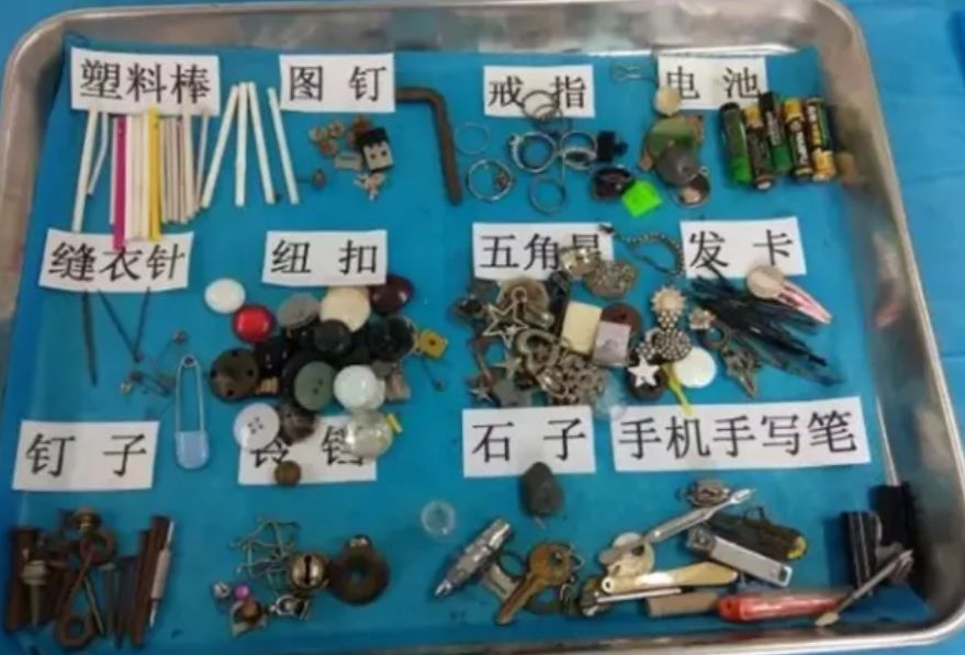 一岁男童吞别针,小孩误吞异物到食道怎么办