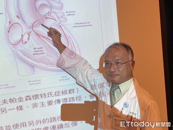 心律失常循证精准用药,wpw综合征b型的心电图表现