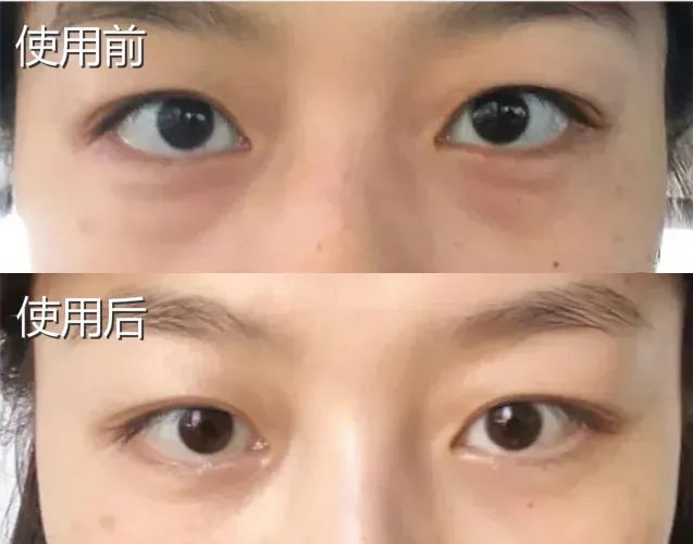 国货眼霜马应龙八宝,马应龙去黑眼霜官方旗舰店