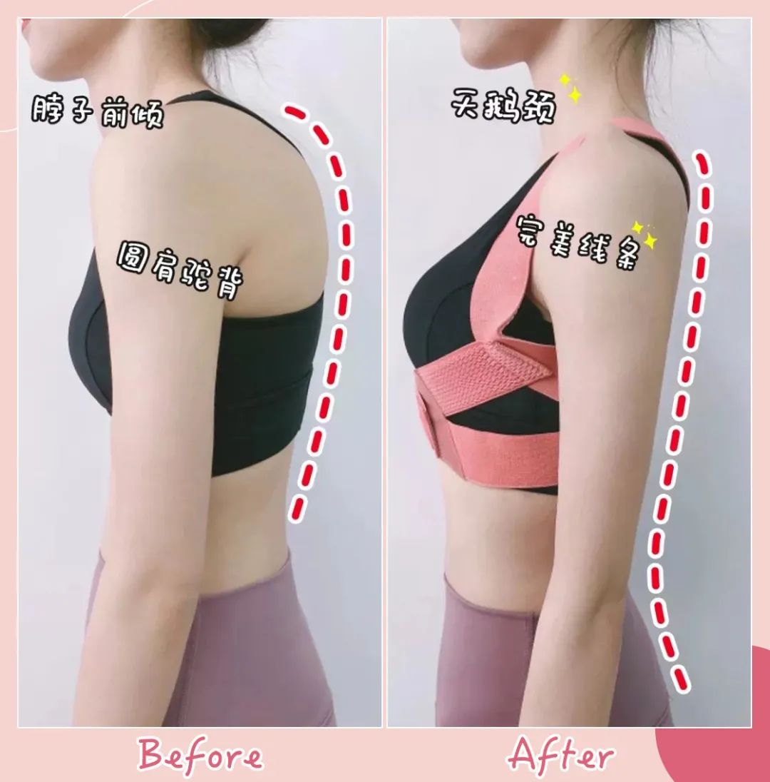 驼背平时自己注意可以改善吗,驼背如何矫正自己的气质