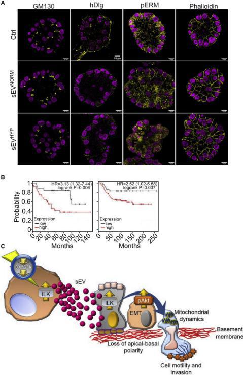 「Cell子刊」乳腺癌细胞利用外囊泡“对话”挟持正常细胞