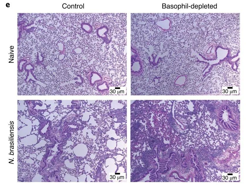 蠕虫感染的例子,蠕虫感染怎么治