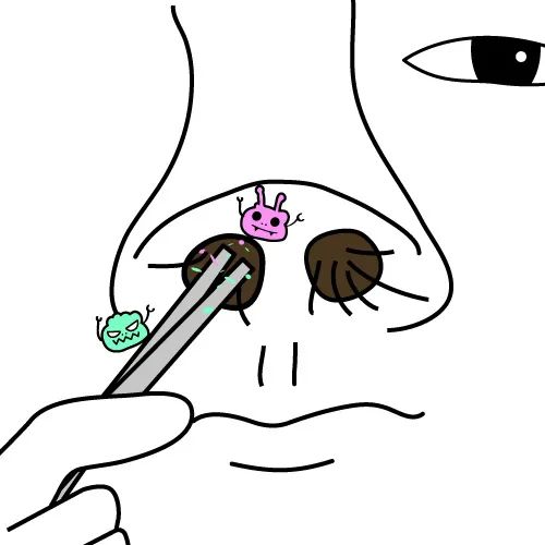 鼻毛拔了又长,鼻毛拔光了还能长出来吗