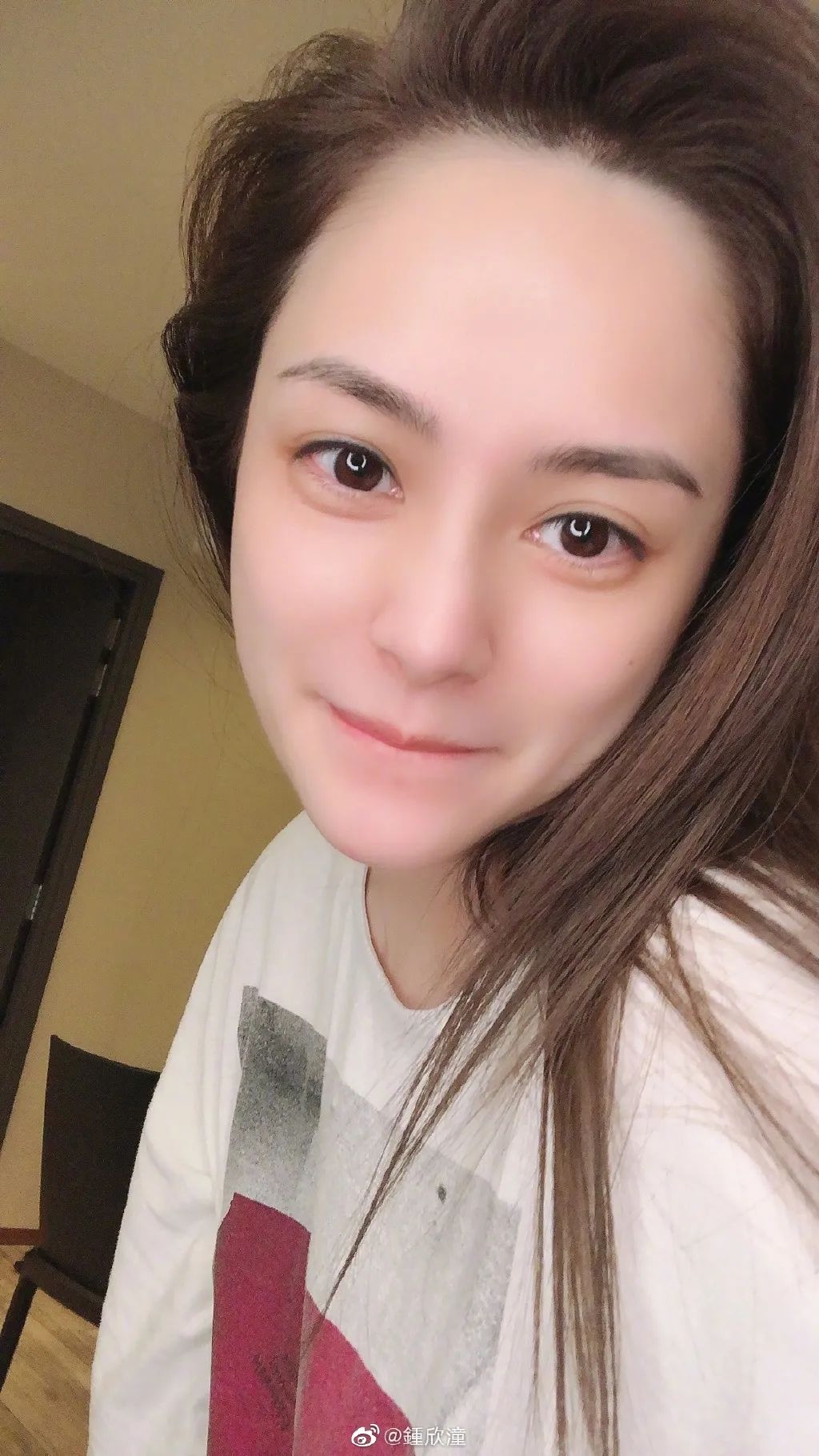 阿娇跌倒受伤,阿娇撞到额头